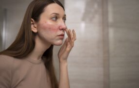 woman looking at psoriasis in mirror