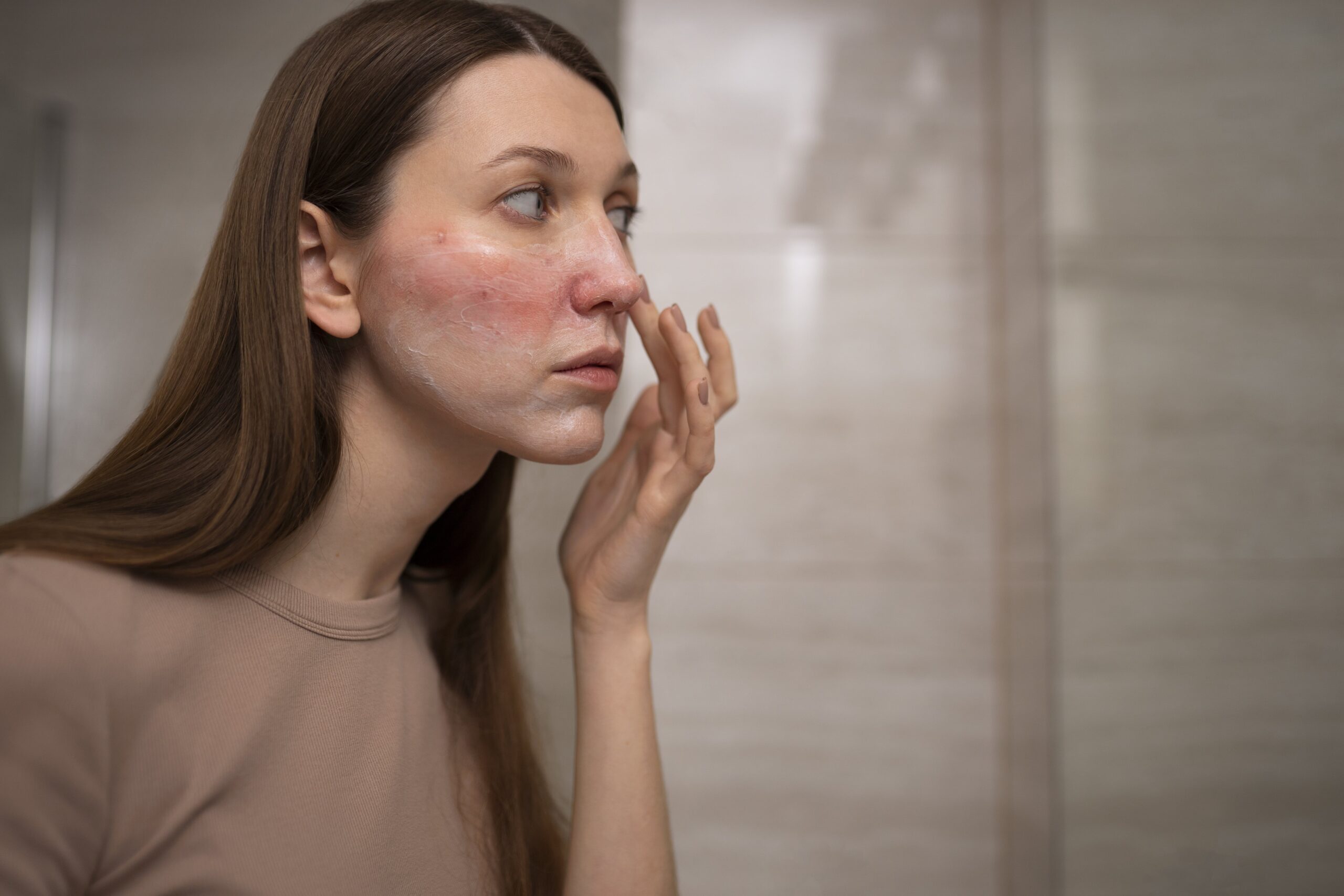 woman looking at psoriasis in mirror